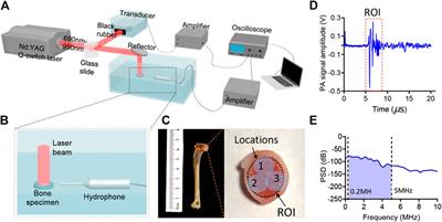 Bone Chemical Composition Analysis Using Photoacoustic Technique